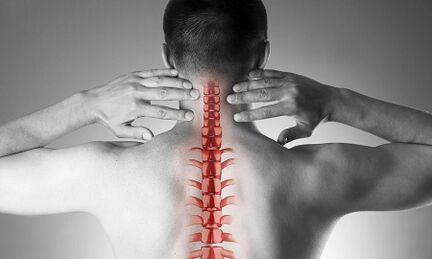 Hoe osteochondrose van de cervicale wervelkolom zich manifesteert