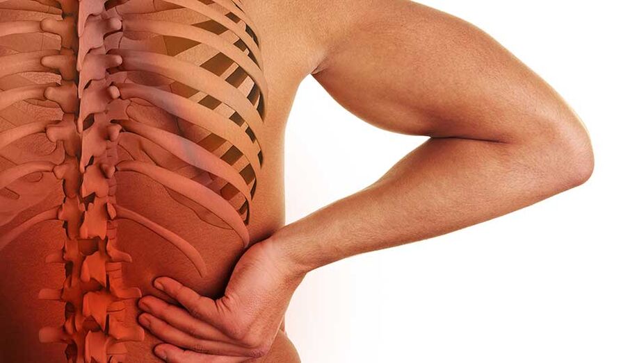 Osteochondrose van de lumbale wervelkolom