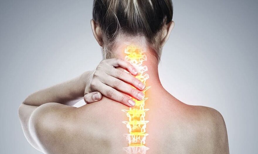 Osteochondrose van de cervicale wervelkolom